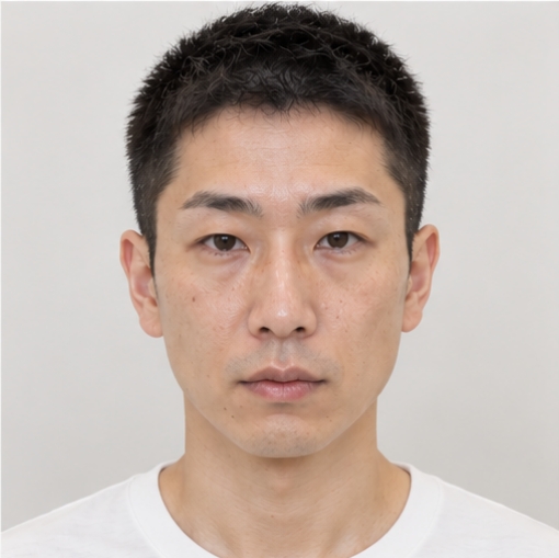 症例Eの施術前